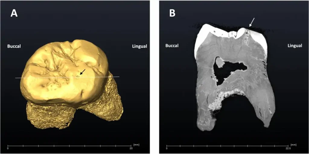 Próchnica sprzed 49 000 lat ujawnia, w jaki sposób neandertalczycy używali ust jako „trzeciej ręki”